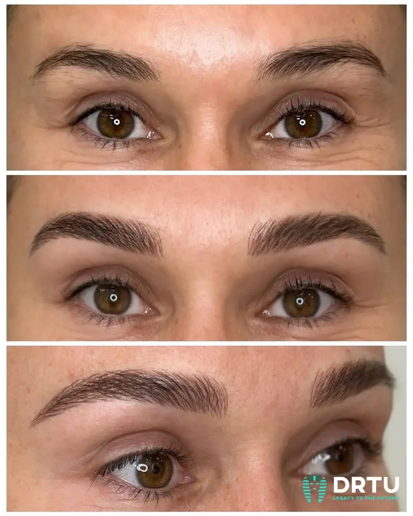 Microblading Sonrası