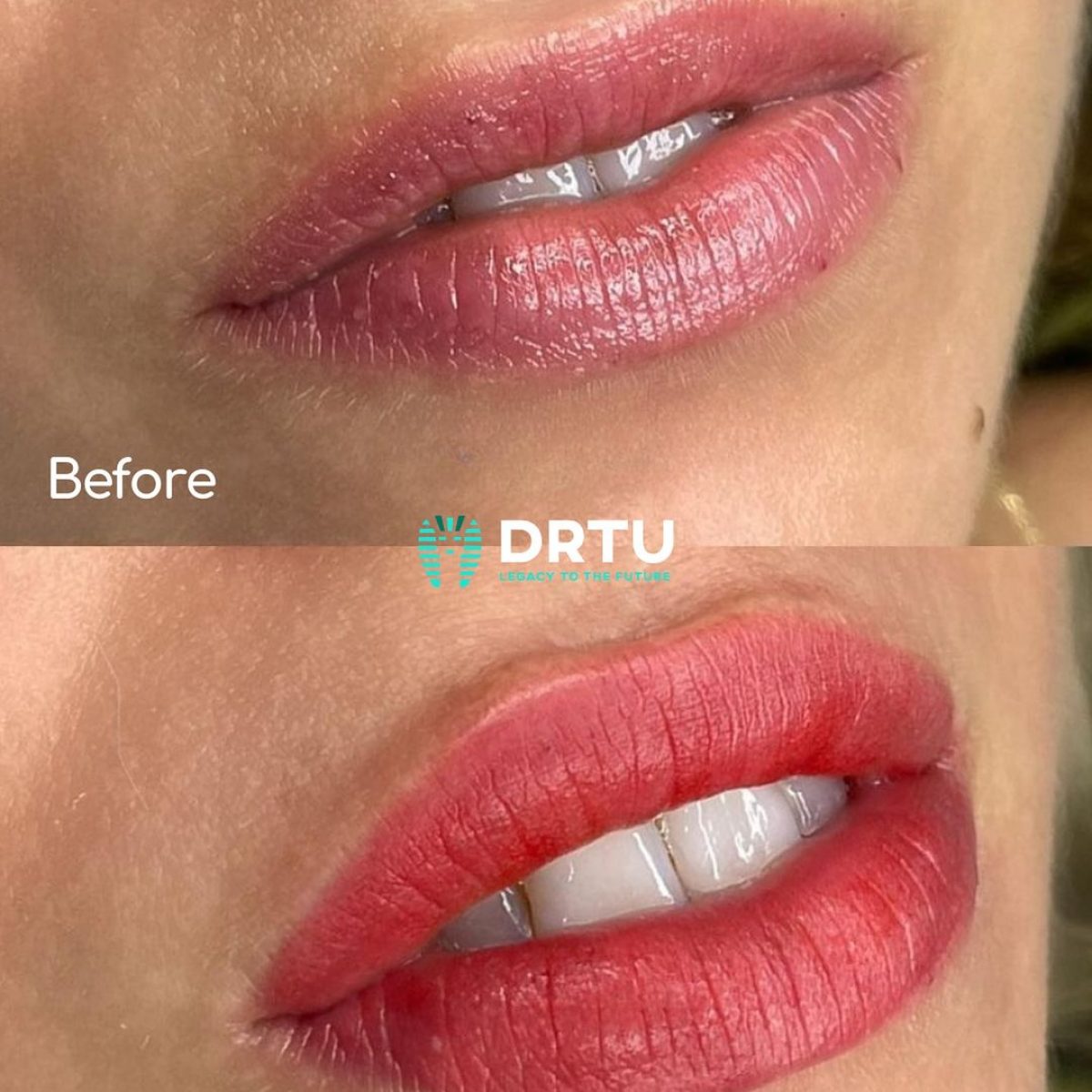 Renk patlaması, özgüven dünyası! Randevu ve detaylı bilgi için, +905323862378A pop of color, a world of confidence! For appointment and detailed information, +905323862378#DrTu #DrTuaestheticandnailart #DrTuG